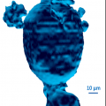 La première image 3D en tomographie protonique d’une cellule humaine isolée. 1998