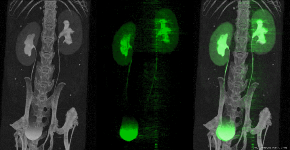 imXgam_Image_K edge iodine composite pixels